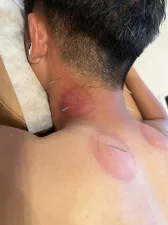 オリーブ鍼灸院