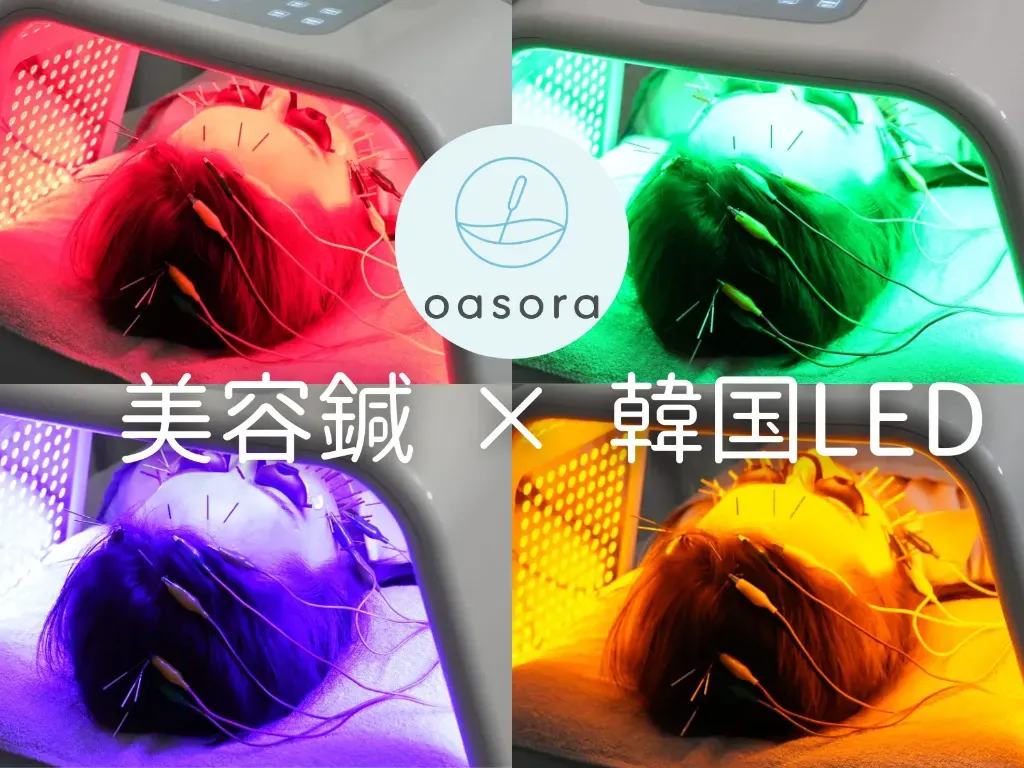 ～美容鍼と体の整えサロン～oasora【オアソラ】