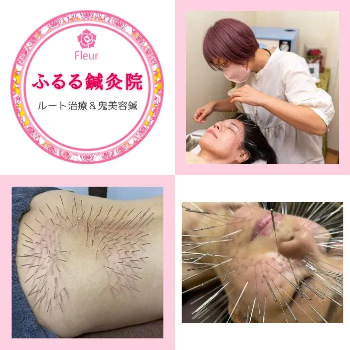 ふるる鍼灸院【鹿児島市|ルート治療】