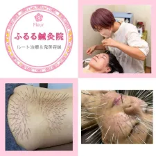 ふるる鍼灸院【女性専用】
