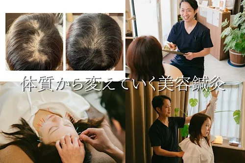 【美容鍼・育毛鍼】きよもと鍼灸院