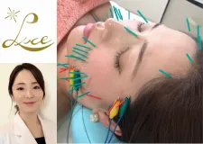 ルーチェ鍼灸整骨院