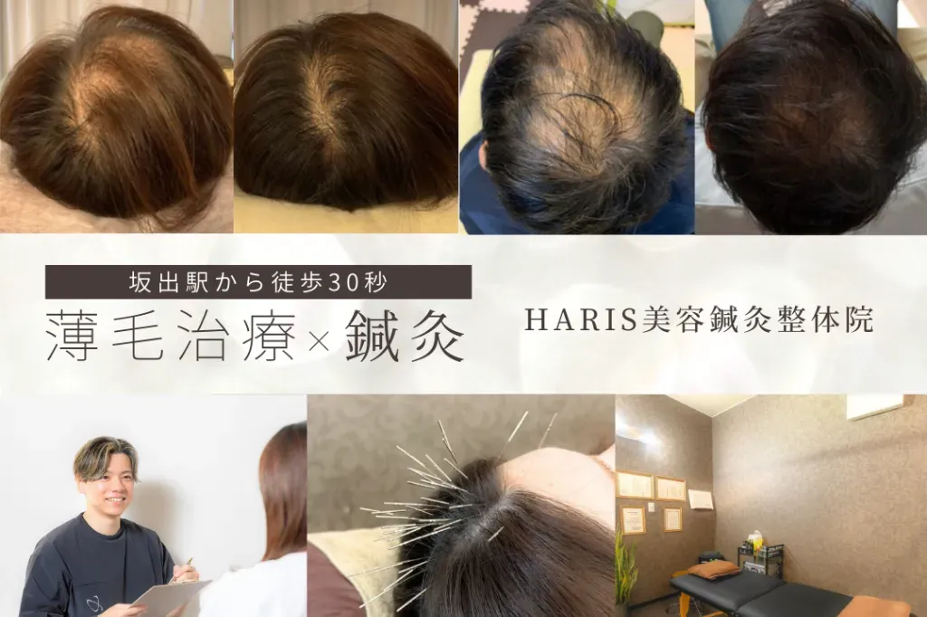 HARIS美容鍼灸整体院