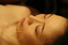 美容鍼・フェイシャル・痩身サロン Acure