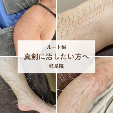 鍼灸院ひかり　岐阜ルート治療院