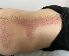 ゴスペル鍼療院