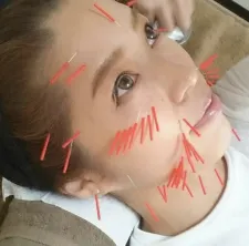 さや鍼灸院