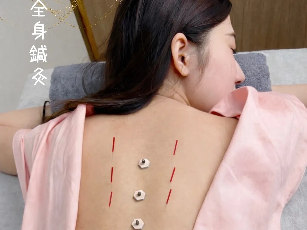 鍼灸院Amu-アム-