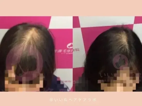 薄毛専門　いいね鍼灸院　大阪院