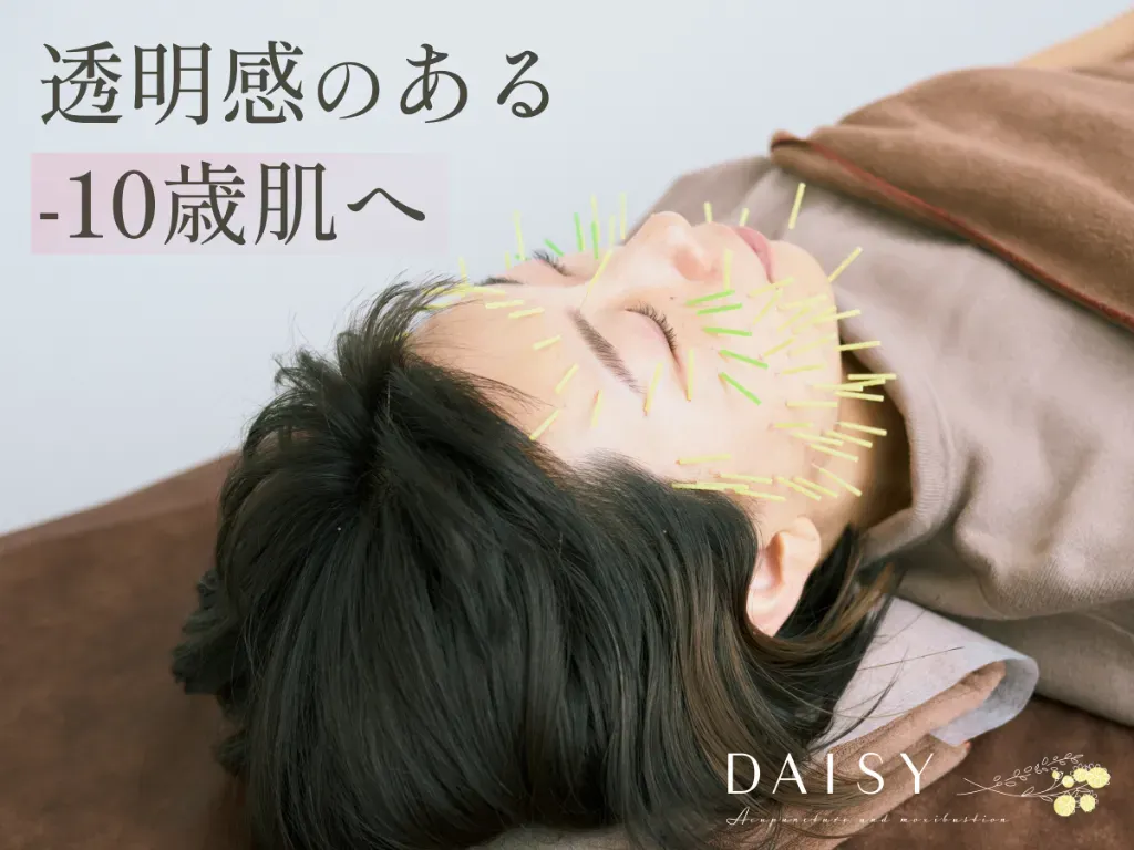 肌質改善専門 美容鍼デイジ―南浦和店