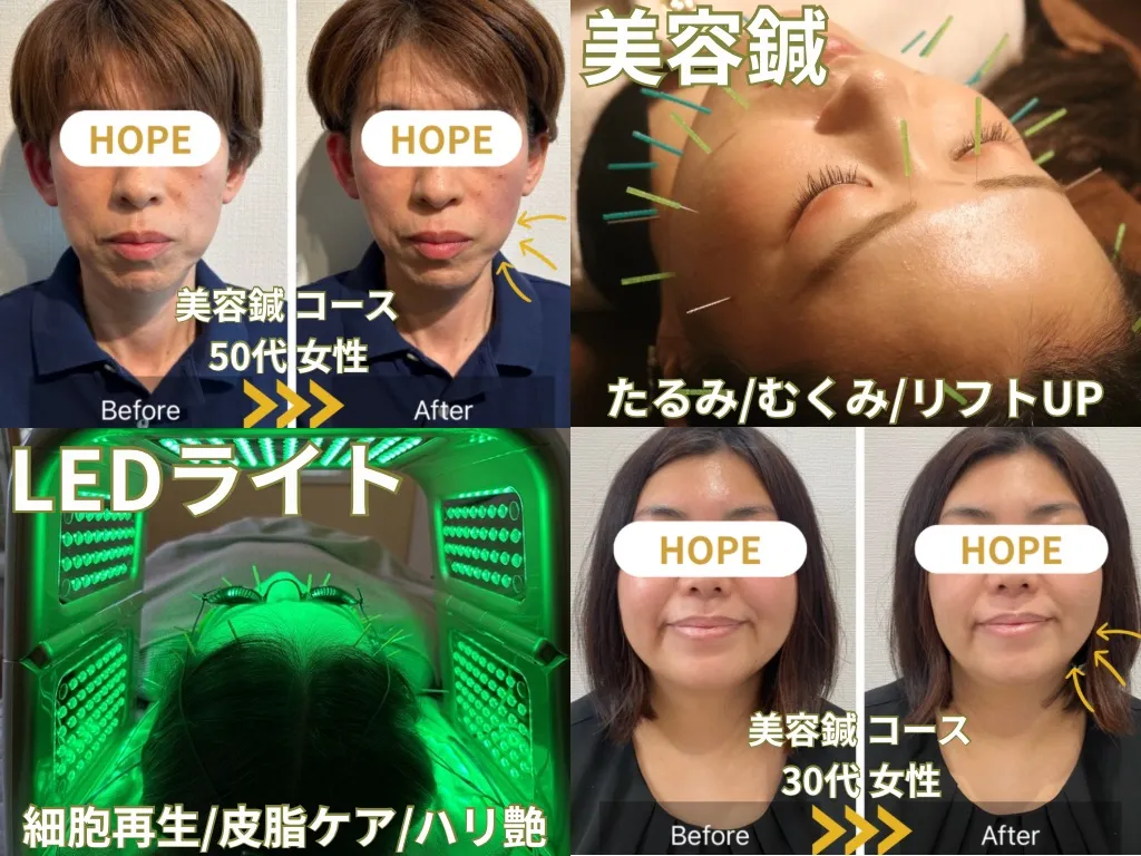 HOPE 美容鍼灸整体院