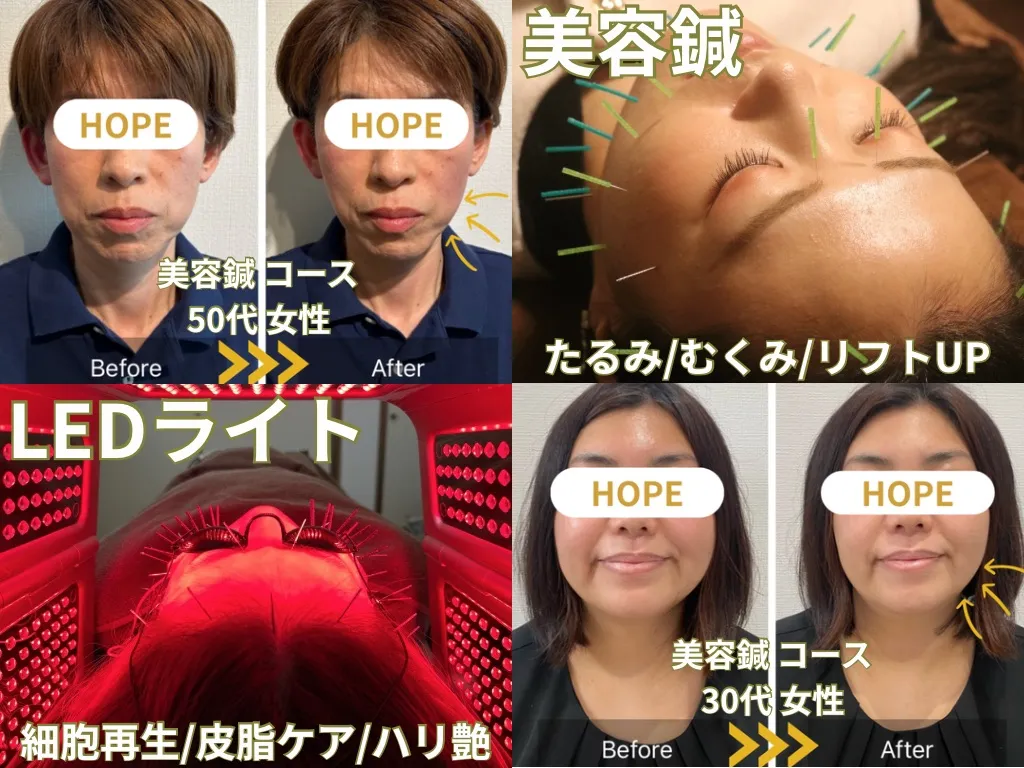 HOPE 美容鍼灸整体院