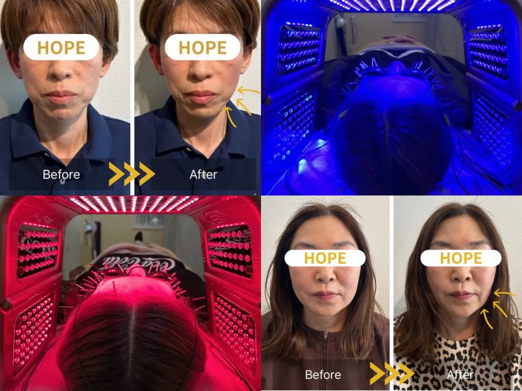 HOPE 美容鍼灸整体院