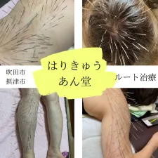 はりきゅうあん堂【ルート治療|女性専用】