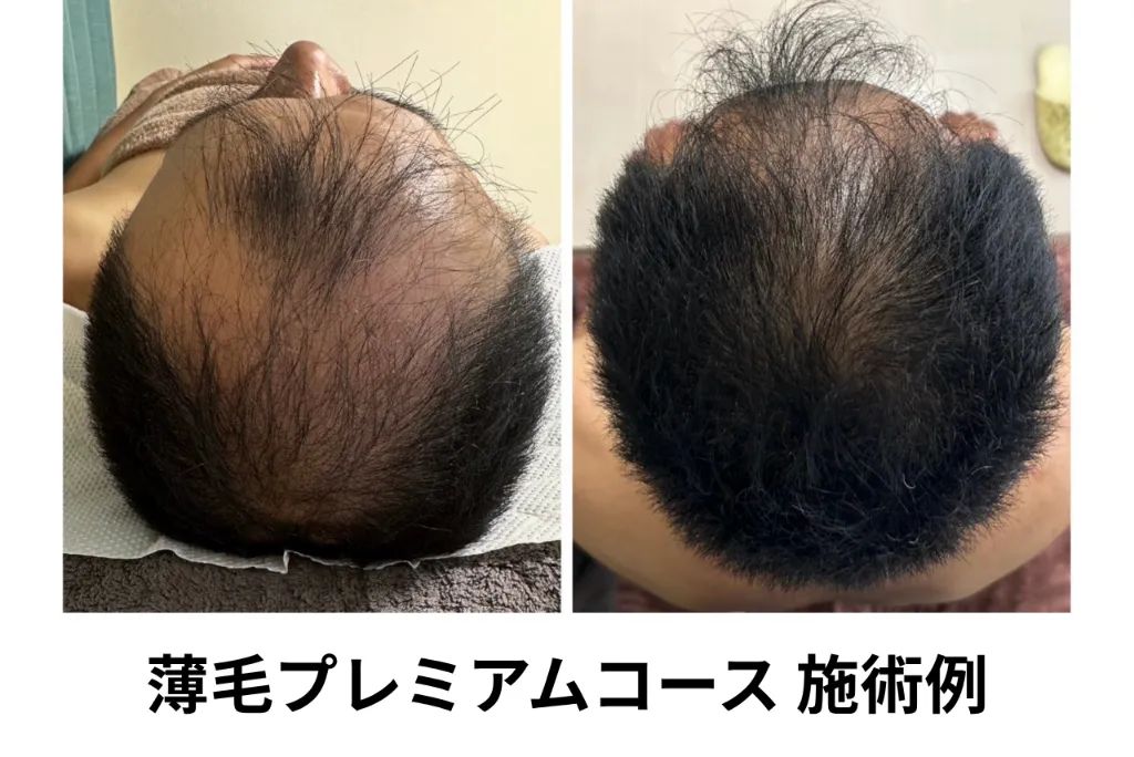 RISA鍼灸院