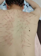 鍼灸マッサージ 蒲田のむすび