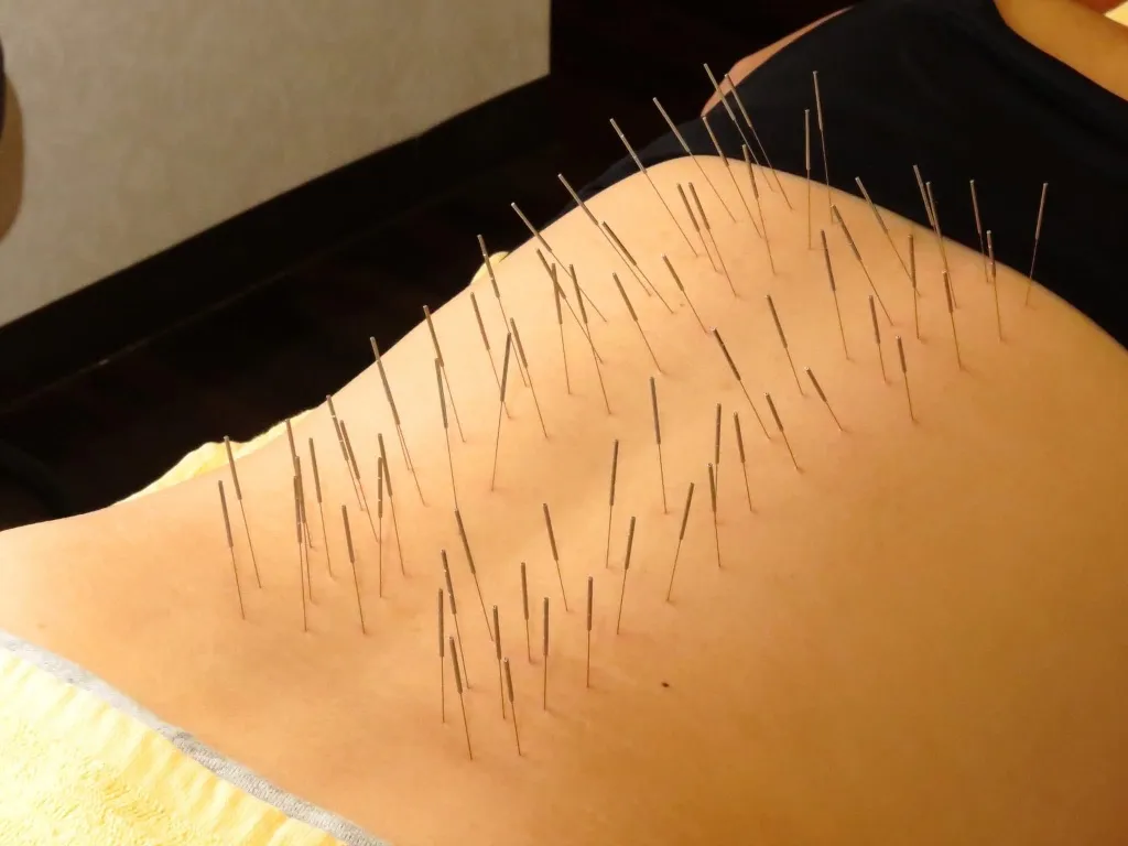 はりきゅう整骨　泰然