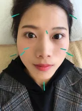 コスモ鍼灸院錦分院