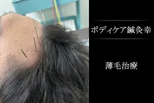 ボディケア 鍼灸 幸