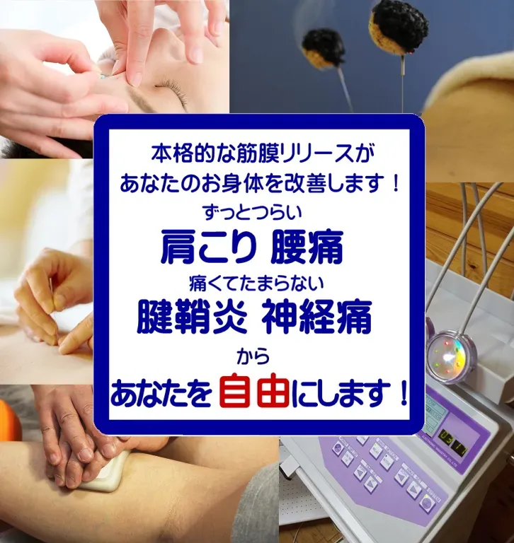 はりきゅう筋膜リリース 鍼灸治療院リーチ