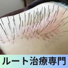 遊雲堂はり治療院【ルート治療専門院】