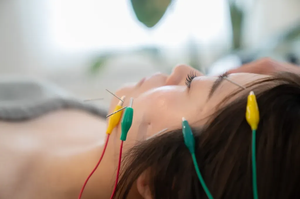【電気を流す美容鍼】あかり鍼灸接骨院