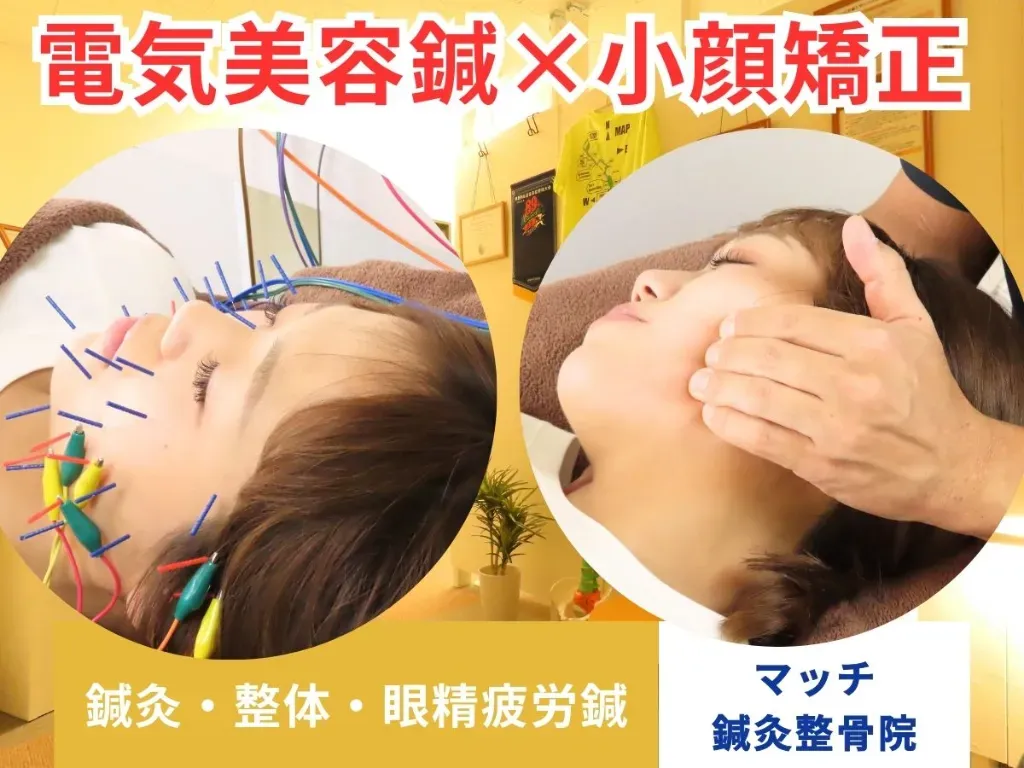 マッチ鍼灸整骨院 