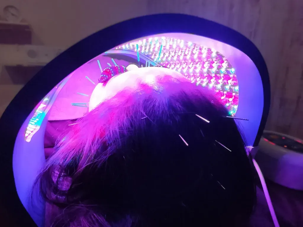 im.Hari™イムハリ全身美容鍼 Body+Beauty Facial Acupuncture