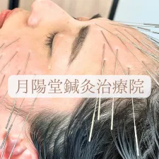 広島美容鍼【月陽堂鍼灸治療院】ルート治療