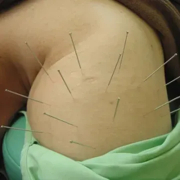 健康第一鍼灸整骨院