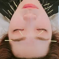 神門美容鍼サロン MEILI(仮)