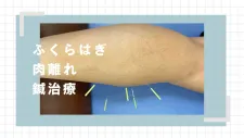 sports therapy &CARE sendai 整体 鍼灸