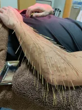 丘の上の治療院ことう