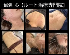 鍼処 心【ルート治療専門院】