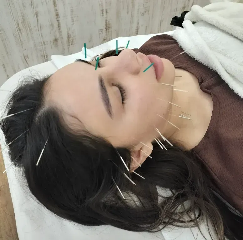 im.Hari™イムハリ全身美容鍼 Body+Beauty Facial Acupuncture 府中