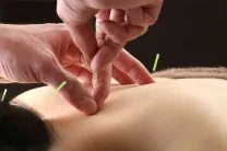 ロータス鍼灸