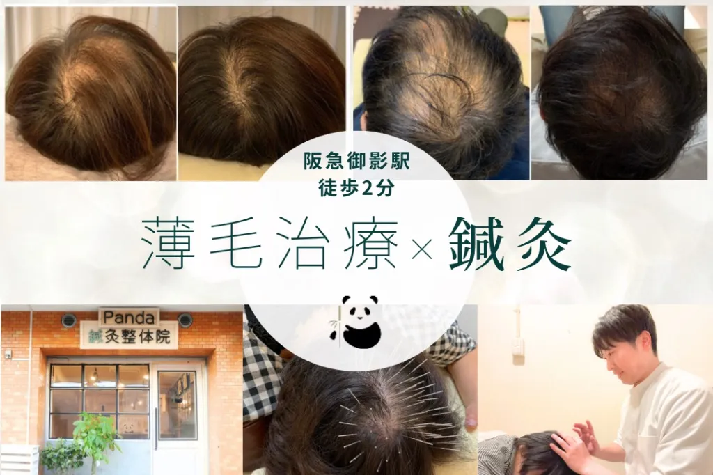 Panda鍼灸整体院(パンダ鍼灸整体院）ダイエット・美容鍼・育毛鍼