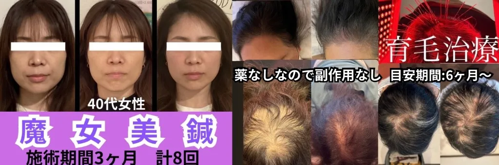 Panda鍼灸整体院(パンダ鍼灸整体院）ダイエット・美容鍼・育毛鍼
