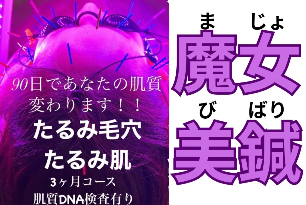 Panda鍼灸整体院(パンダ鍼灸整体院)ダイエット・美容鍼・育毛鍼