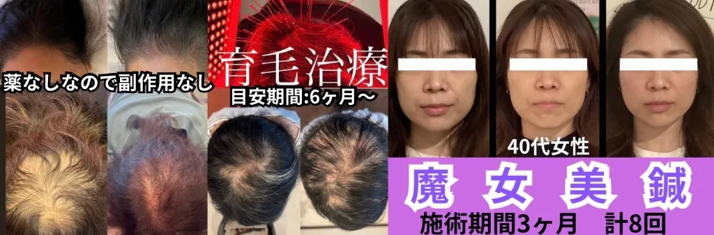 Panda鍼灸整体院(パンダ鍼灸整体院）ダイエット・美容鍼・育毛鍼