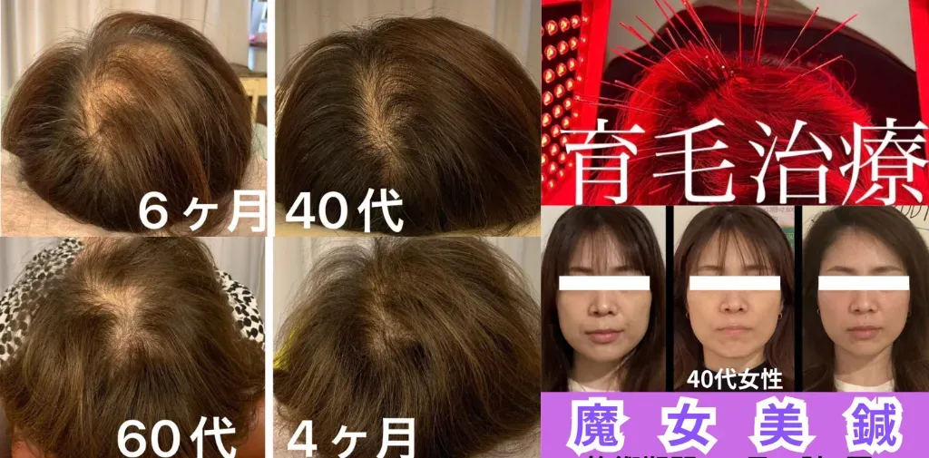 Panda鍼灸整体院(パンダ鍼灸整体院）ダイエット・美容鍼・育毛鍼