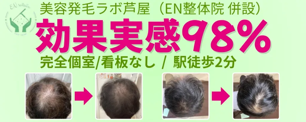 美容発毛ラボ芦屋(EN整体院併設)育毛鍼・美容鍼