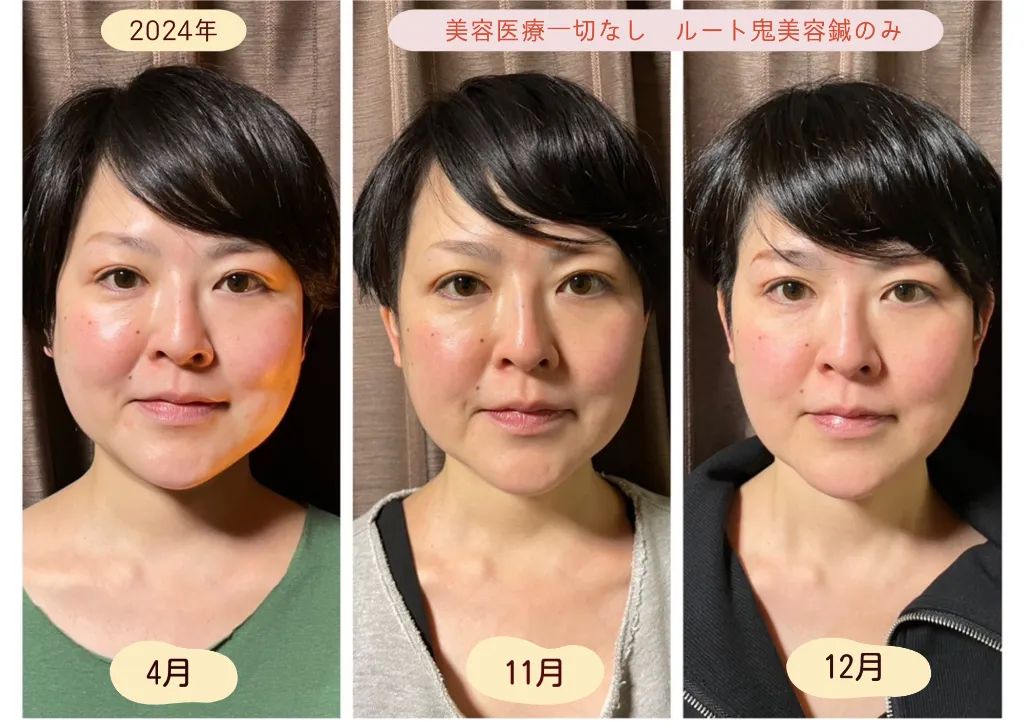 はり処 松陽堂 谷町六丁目 ルート治療 生駒出張所