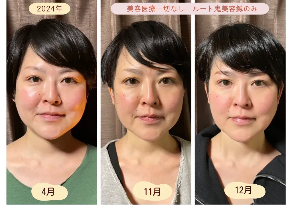 はり処 松陽堂 谷町六丁目 ルート治療 生駒出張所