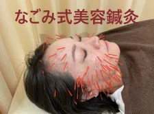 なごみ鍼灸接骨院 吹上院