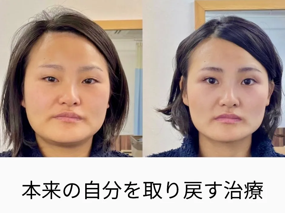 鍼灸Careむらかみ