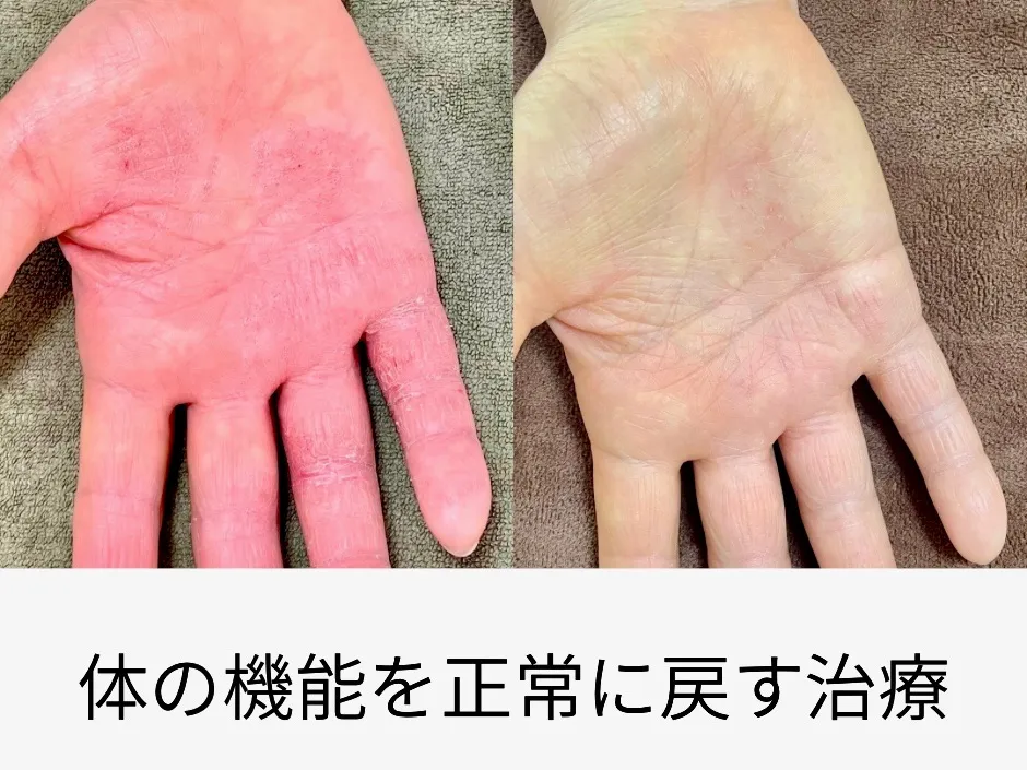 豊中　鍼灸Careむらかみ｜長年続く不調と生きづらさ