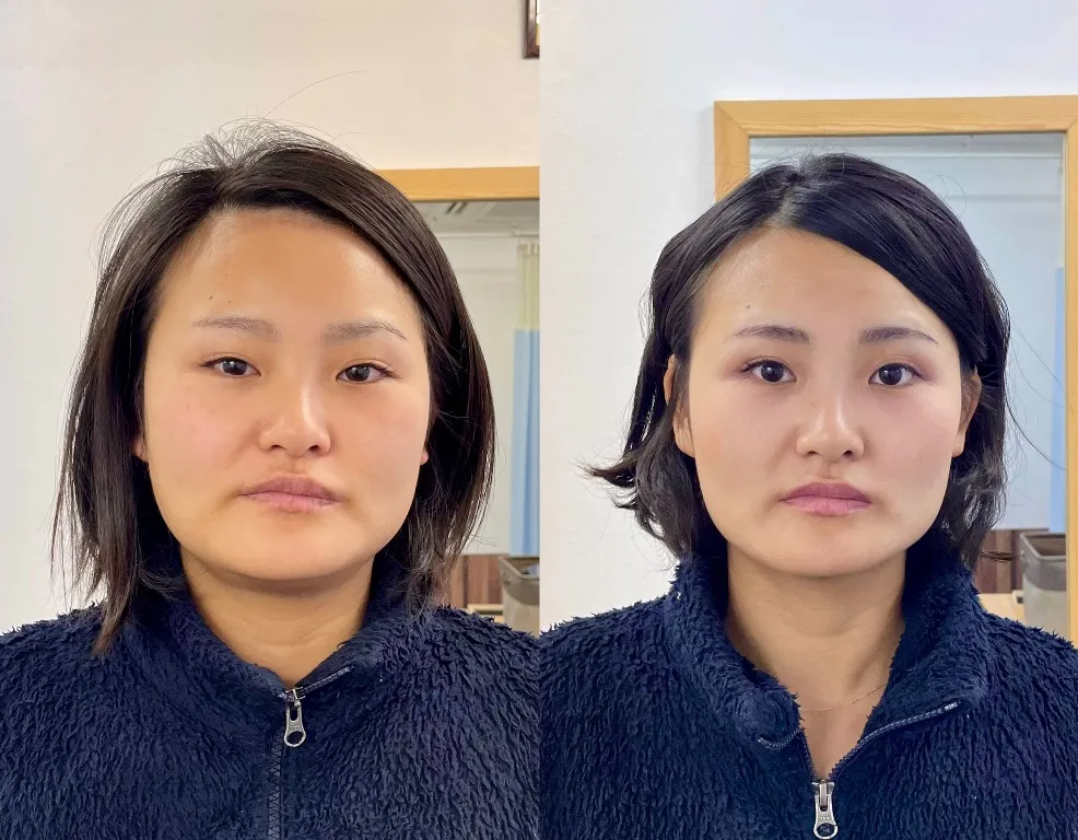 《重症慢性症状専門》鍼灸Careむらかみ