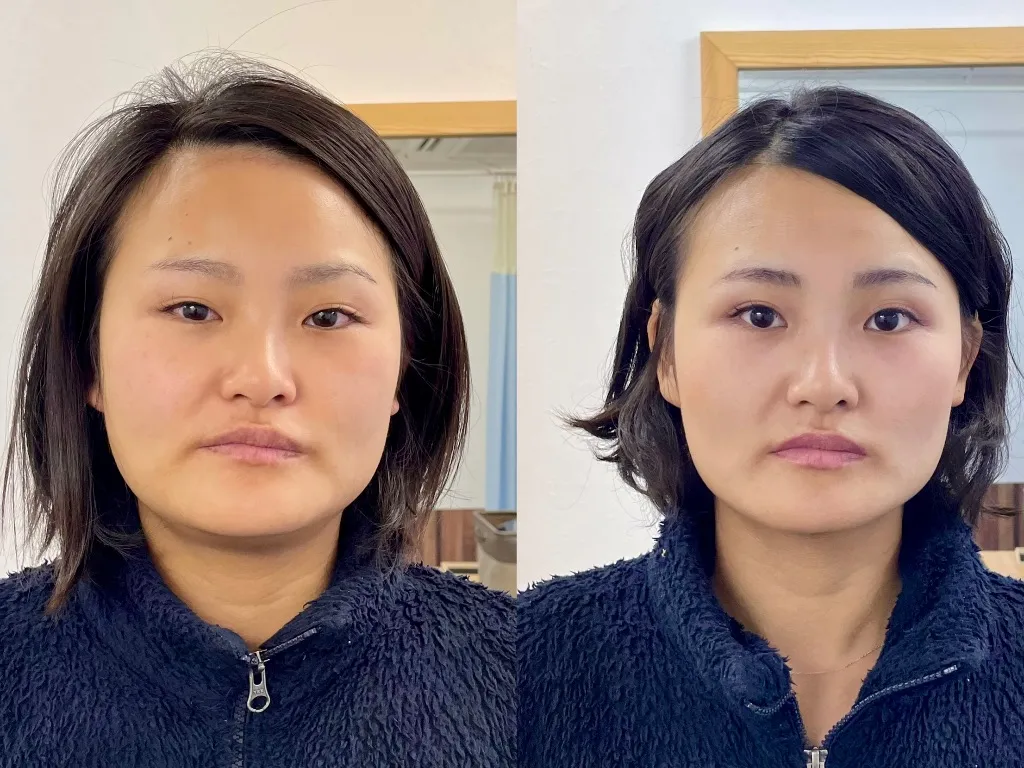 鍼灸Careむらかみ　長年続くお悩み｜調律美容鍼｜本格鍼・整体