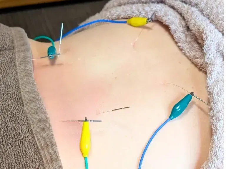 おかやま鍼灸マッサージ院